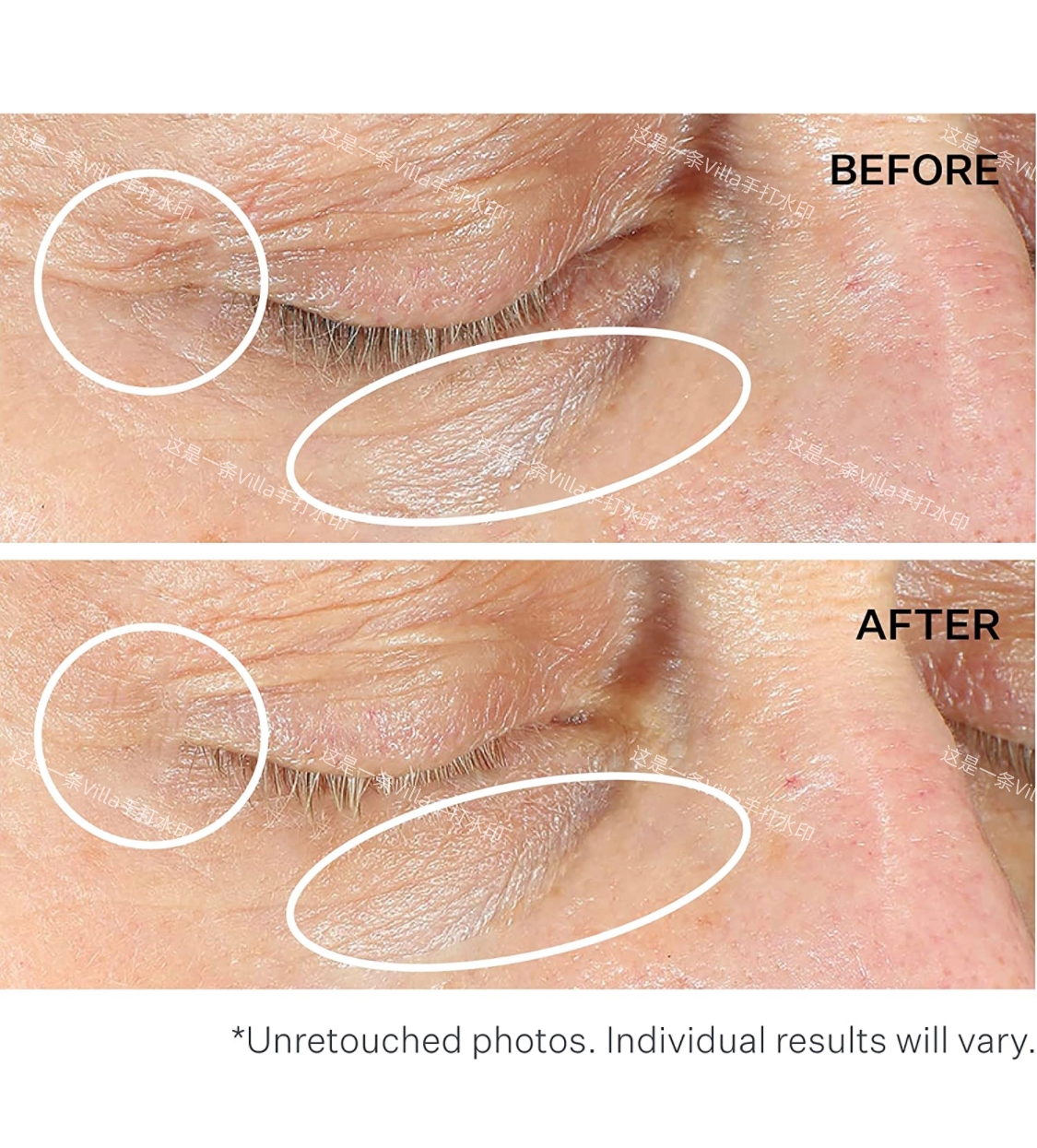 黑五 斯佳唯婷眼霜~电眼美女
黑五🇨🇦斯佳唯婷眼霜
_2