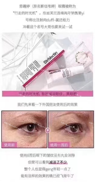 黑五 斯佳唯婷眼霜~电眼美女
黑五🇨🇦斯佳唯婷眼霜
_3